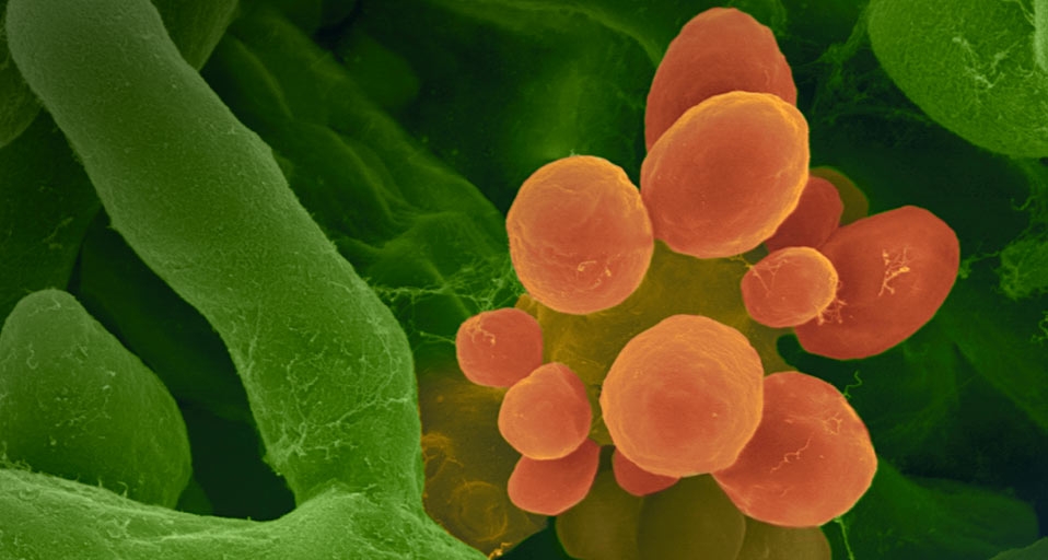 Common indoor/allergenic mould -- Dennis Kunkel microscopy, Inc./Visuals Unlimited &copy; (Bing United Kingdom)