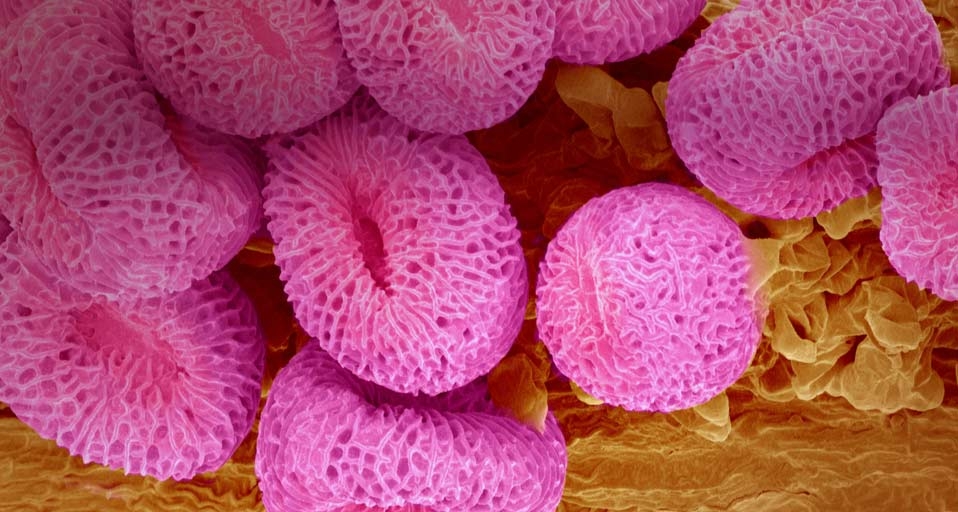 Geranium pollen at a magnification of x400 (© Micro Discovery/Corbis) &copy; (Bing Canada)