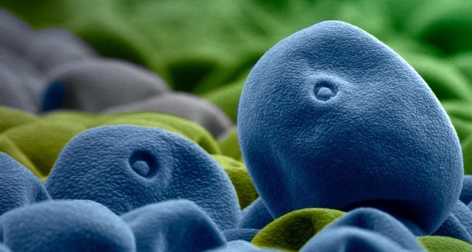 Timothy grass pollen (© Bob Sacha/Corbis) &copy; (Bing Canada)