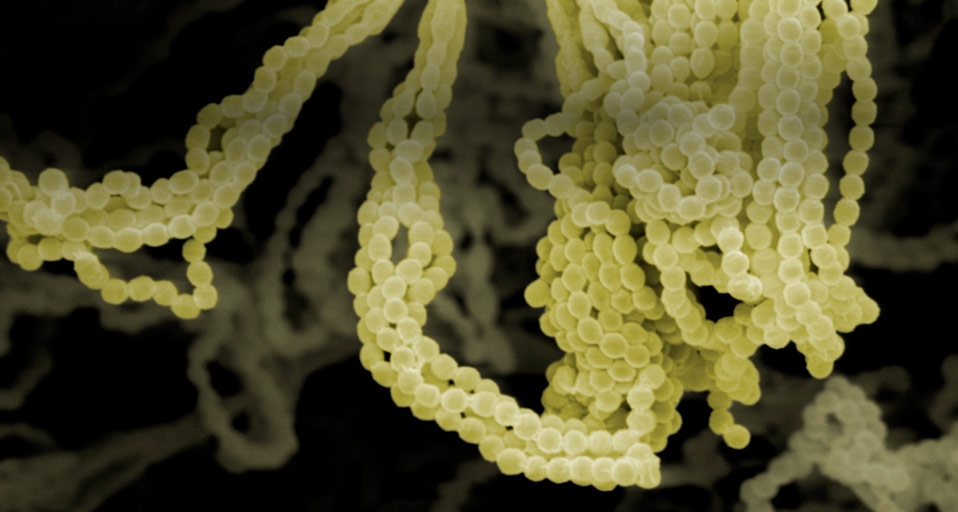 Scanning electron microscope image of Penicillium Notatum , the fungus that is the source of the antibiotic Penicillin -- Visuals Unlimited/Corbis &copy; (Bing United States)