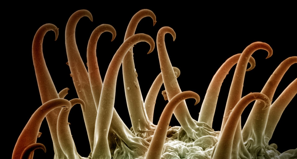 Scanning electron micrograph photo of Cocklebur (Xanthium) seeds -- Richard Kessel/Visuals Unlimited, Inc. &copy; (Bing Canada)