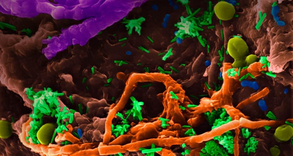 A variety of bacteria, yeast, and fungus on a kitchen sponge (© Dennis Kunkel Microscopy, Inc./Visuals Unlimited, Inc.) &copy; (Bing United Kingdom)