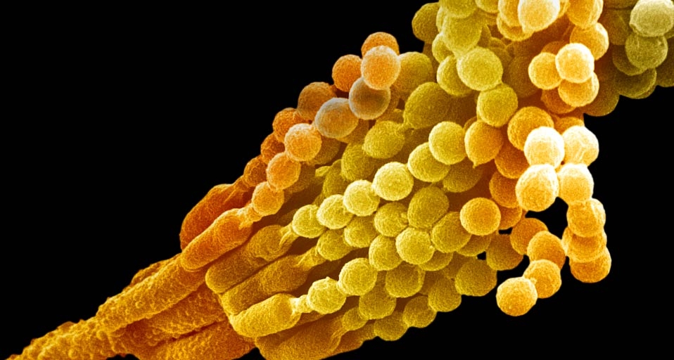 Penicillium notatum showing conidiophores and conidia - Dr Fred Hossler/Getty Images &copy; (Bing United Kingdom)